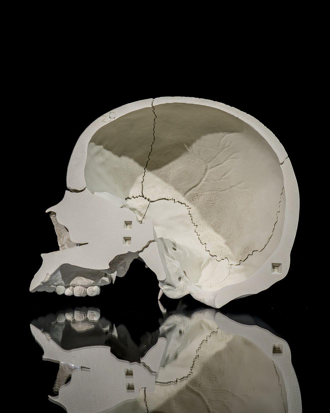 Human Adult Skull Human body Collection